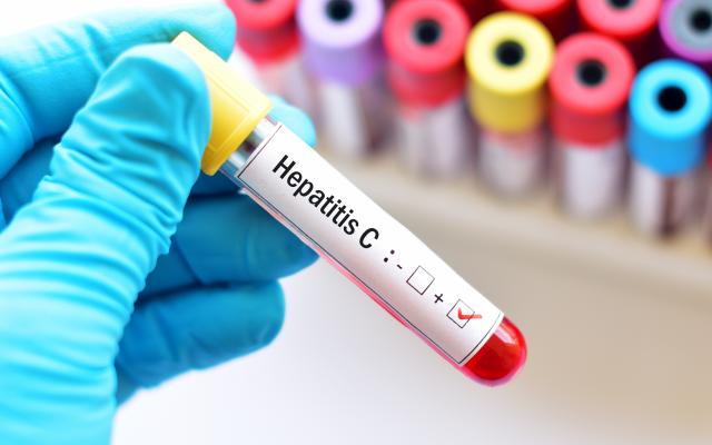 Op een buisje staat 'Hepatitis C'.