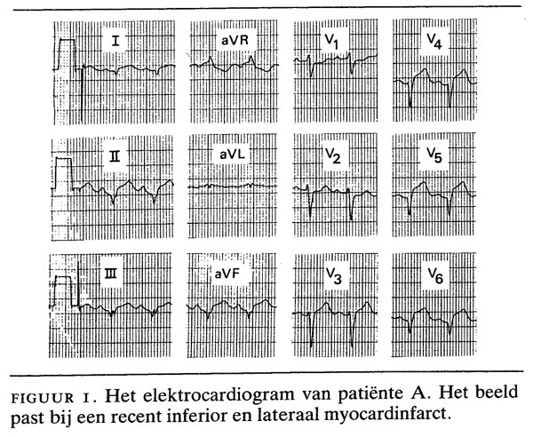 Normale kransslagaders en toch een hartinfarct? | Nederlands