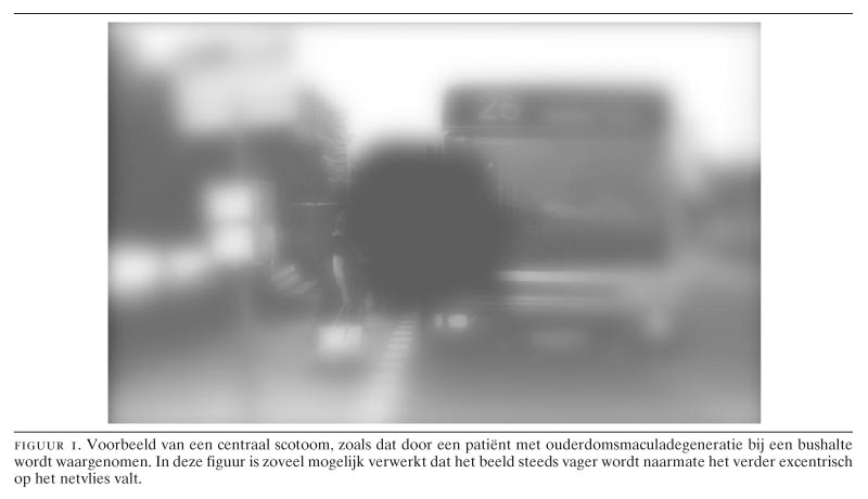 Visuele rehabilitatie van patiënten met ouderdomsmaculadegeneratie ...
