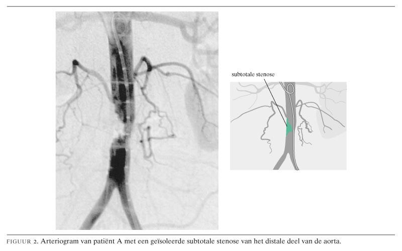 Klinisch denken en beslissen in de praktijk. Een verpleegster met pijn