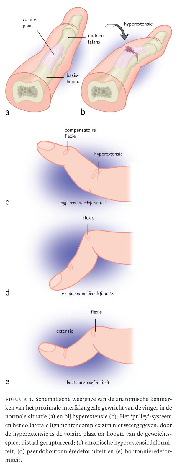 inflamația dimexidului articulației ligamentelor tratamentul deformării artrozei la încheietura mâinii