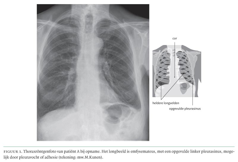 Klinisch Denken En Beslissen In De Praktijk Een Patient Met Koorts En Pancytopenie Nederlands Tijdschrift Voor Geneeskunde Klinisch Denken En Beslissen In De Praktijk Een Patient Met Koorts En Pancytopenie Nederlands Tijdschrift Voor Geneeskunde