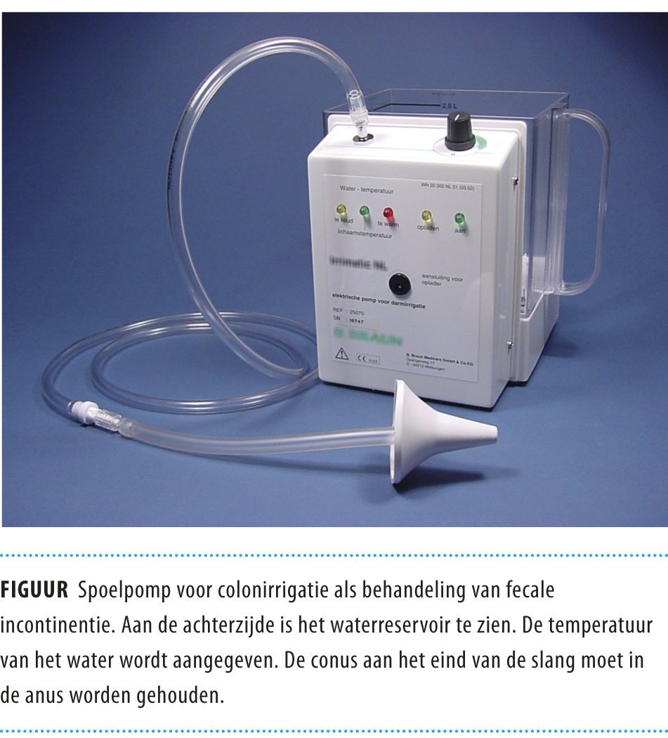 Zelf retrograad spoelen Nederlands Tijdschrift voor Geneeskunde Zelf retrograad spoelen Nederlands Tijdschrift voor Geneeskunde