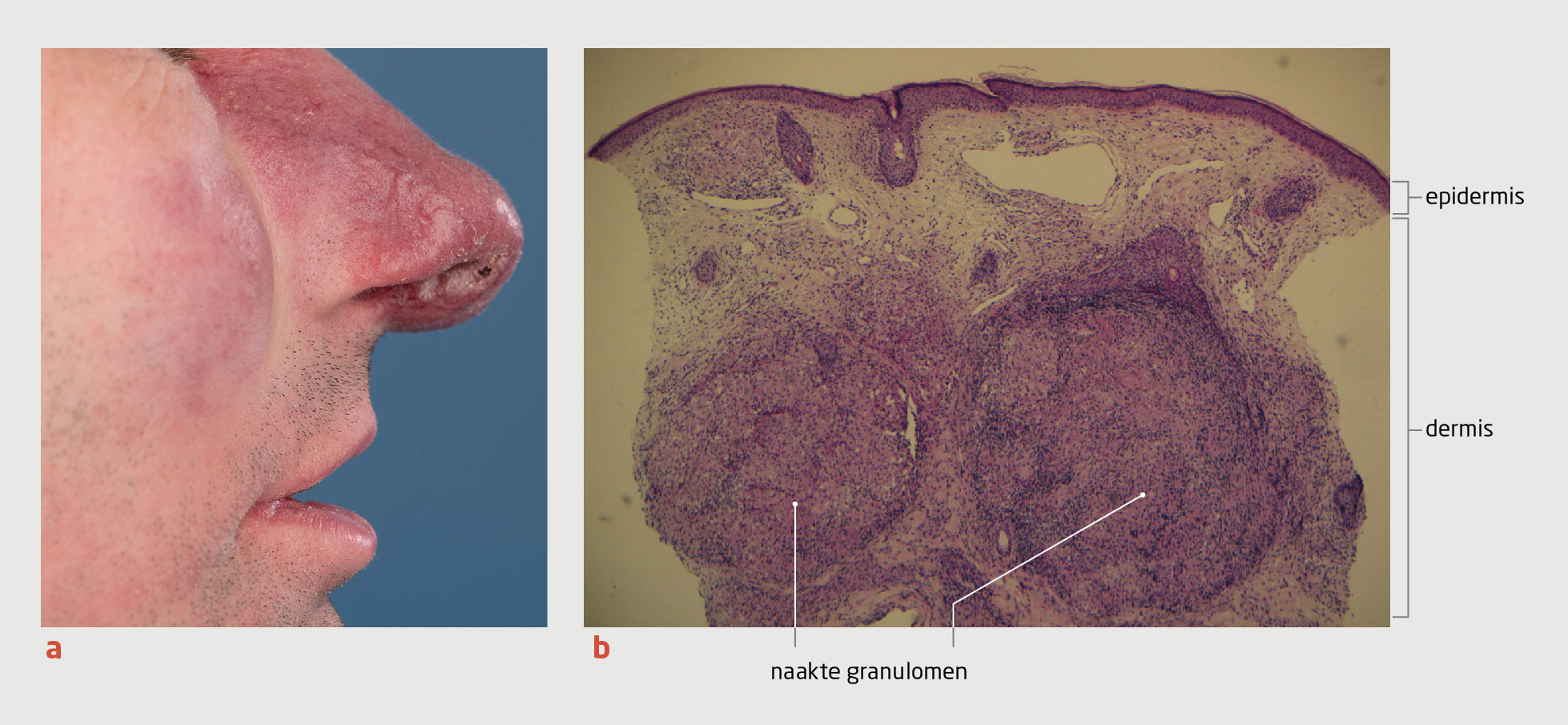 Bezi kiygan lezbiyenlar