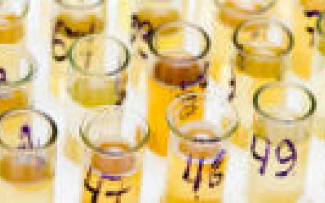 Sneller duidelijkheid over antibioticaresistentie bij urineweginfecties