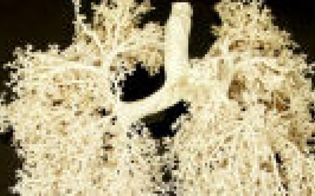 Transplantatie met longen van euthanasiepatiënt