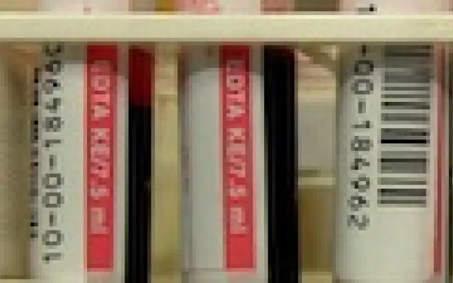 Bloedtest voorspelt geslacht accuraat