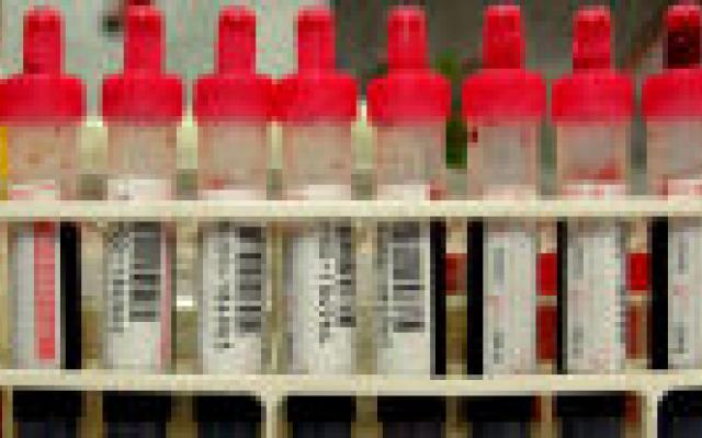 Nieuwe review bevestigt: PSA screening niet zinvol