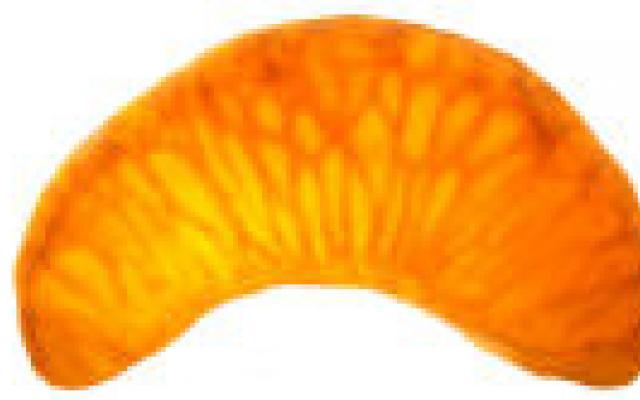 Massage met mandarijnolie op kinder-IC niet zinvol