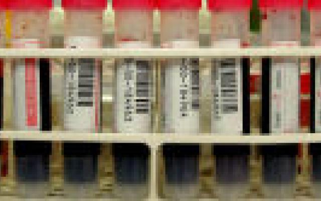 Syndroom van Down detecteren in maternaal bloed: nu nog onderzoek in de algemene populatie