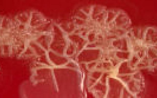 Bacteriën knappen muurschildering op