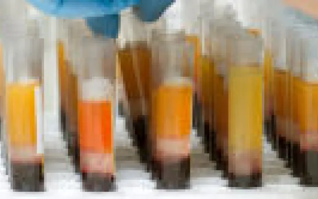 Risico op sterfte na trombose langdurig verhoogd