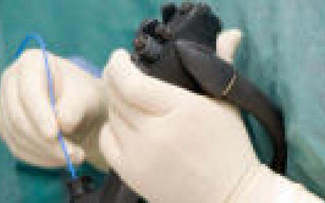 Minder ontsteking na endoscopische necrosectomie bij pancreatitis