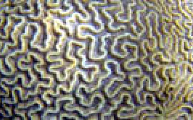 Operatie hersentumor beter met ‘mapping’