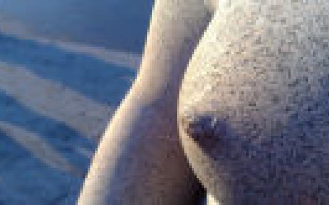 PIP-implantaten lekken bij 30% van de vrouwen