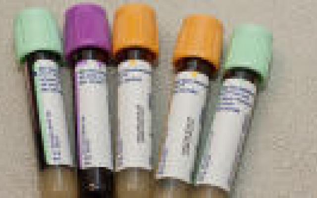 Ook op lange termijn veel klachten en achteruitgang bij multipel myeloom