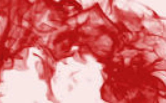 Hiv-behandeling verhoogt risico op intracraniële bloedingen bij hemofilie