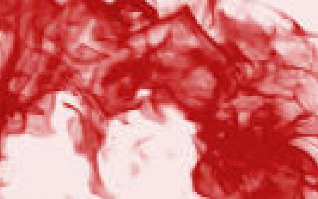 Hiv-behandeling verhoogt risico op intracraniële bloedingen bij hemofilie