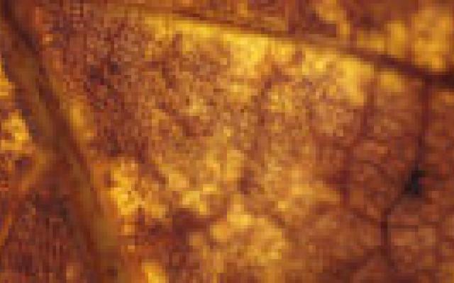 Vasculair risico ook na bypass hoog bij slagaderverkalking