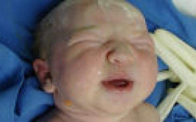 Kinderen met ademhalingsproblemen door opiaten