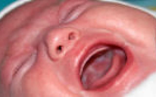 Afwijkend microbioom bij huilbabies