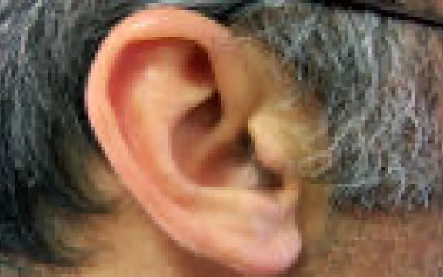 Bespoedigt gehoorverlies cognitieve achteruitgang?