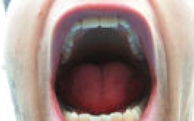 Mogelijke interacties bij orale kankertherapie