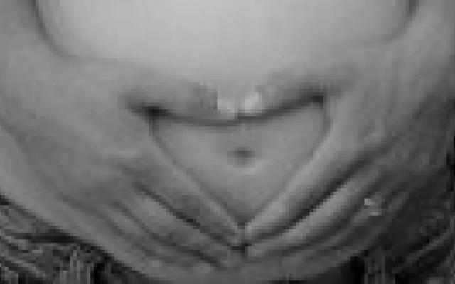 Screening op downsyndroom niet erg populair