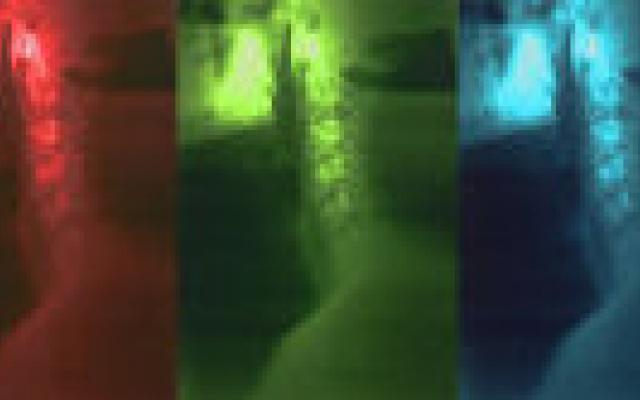 Flexie-extensiefoto voegt weinig toe