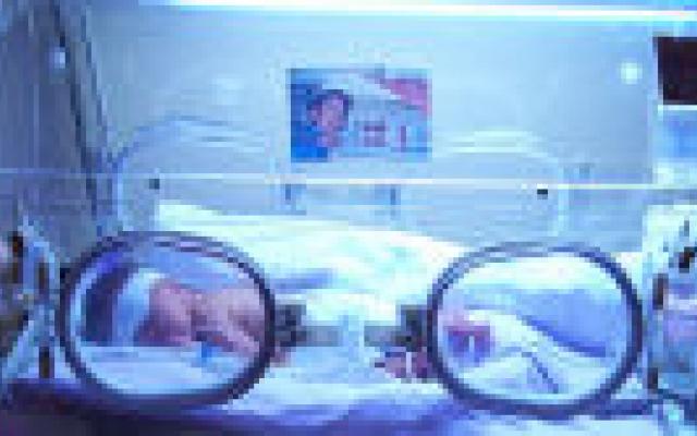 Voorspellen ontwikkeling extreme prematuren blijft lastig