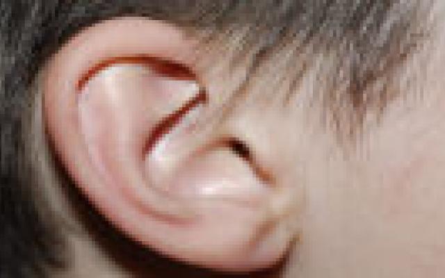 Niet te snel een cochleair implantaat bij premature baby’s