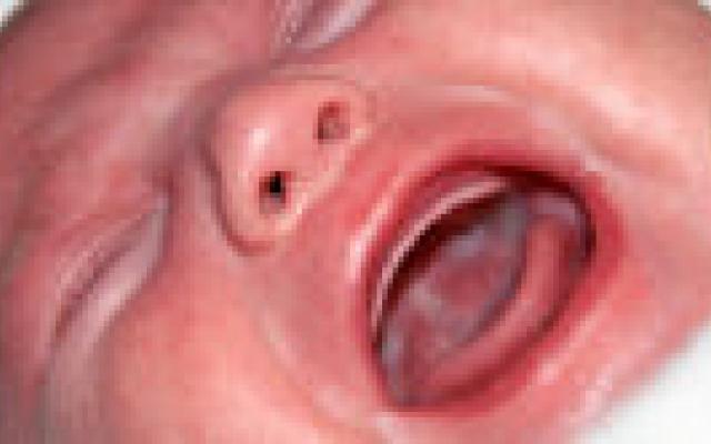 Ontroostbaar huilen voorspelt depressieve klachten