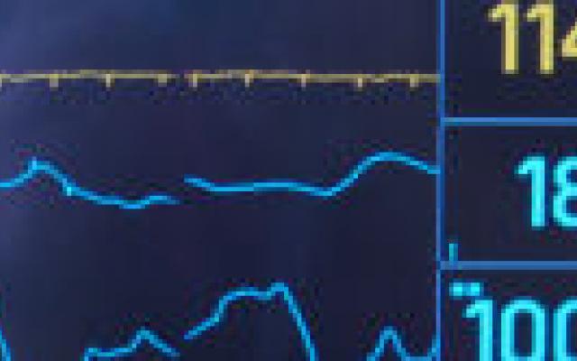 Gerichte feedback en verbeterteams leiden niet tot betere uitkomsten op de IC