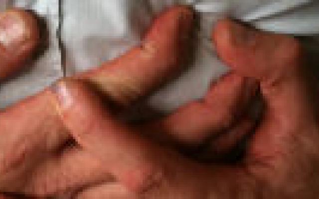 Minder ziekenhuisopnamen voor hartfalen: niet dankzij betere huisartsen