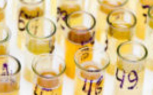 Geen invloed urinezuurmetabolisme op hartziekte