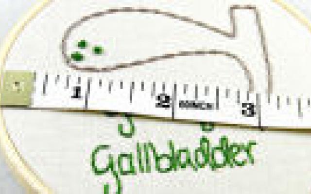 Routine-PA galblaas wellicht overbodig