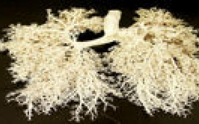 Achterblijvende palliatieve zorg voor COPD-patiënten