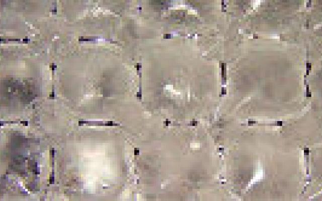 Koelen hoofdhuid tijdens chemotherapie tegen kaalheid kosteneffectief