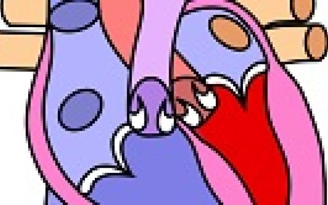 Incidentie trombose steunhart stijgt onverwacht