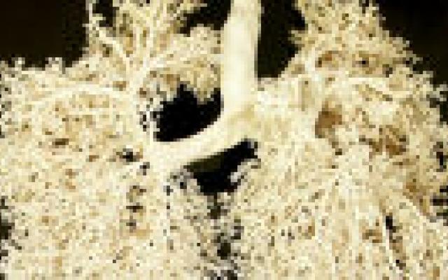 Van longkankerdiagnosen bij CT-screening bijna een vijfde niet relevant