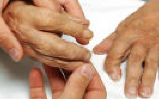 Medicinale behandeling bij reumatoïde artritis relatief veilig