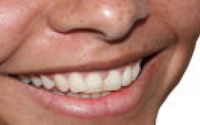 Geen toename gaatjes