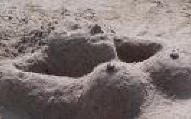 ‘Operatietechniek heeft geen invloed op patiënttevredenheid na borstreconstructie’