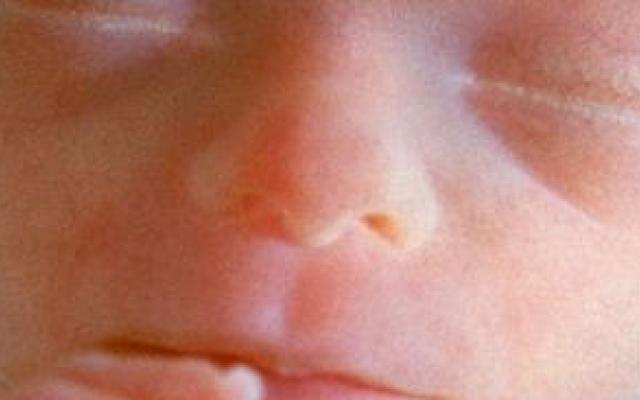 Nieuwe methode foetale chirurgie