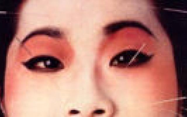 China wil ISO-normen voor acupunctuur