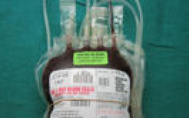 Bloedtransfusie verhoogt infectierisico na bypassoperatie