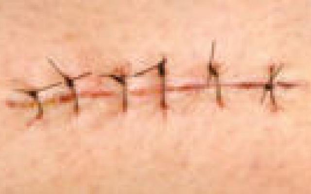 Appendix geen overblijfsel van de evolutie