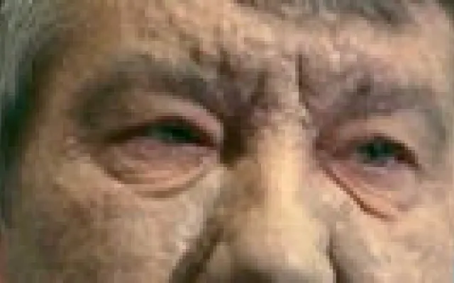 De vergiftiging van Viktor Joesjtsjenko
