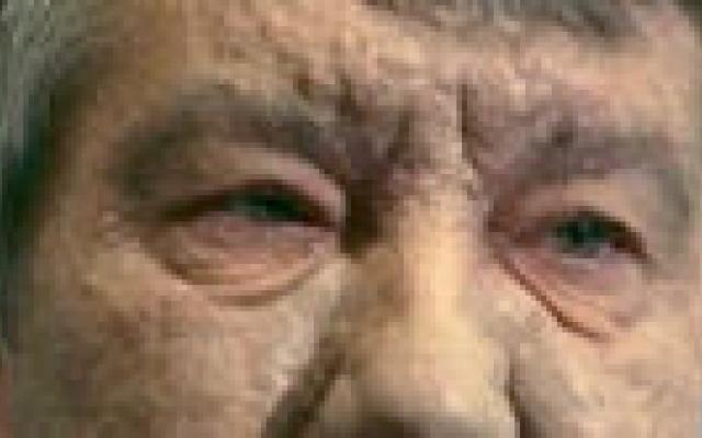 De vergiftiging van Viktor Joesjtsjenko