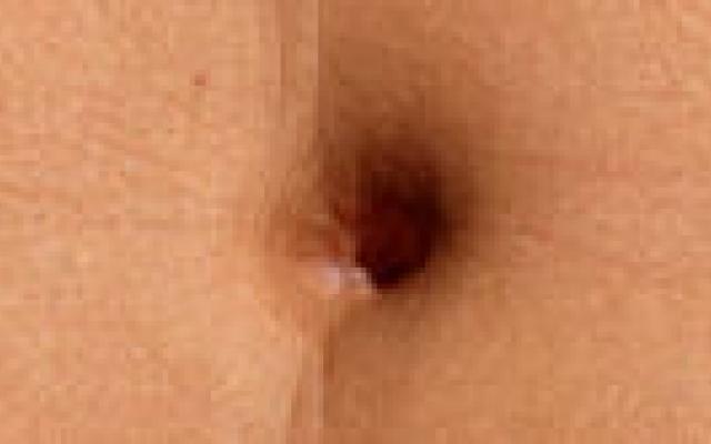 Maagverkleining bij tieners heeft direct effect